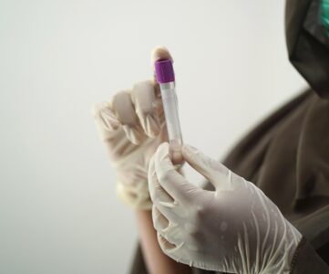 Probówka z próbką krwi w laboratorium