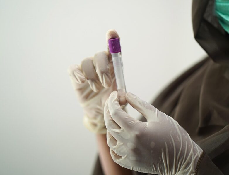 Probówka z próbką krwi w laboratorium
