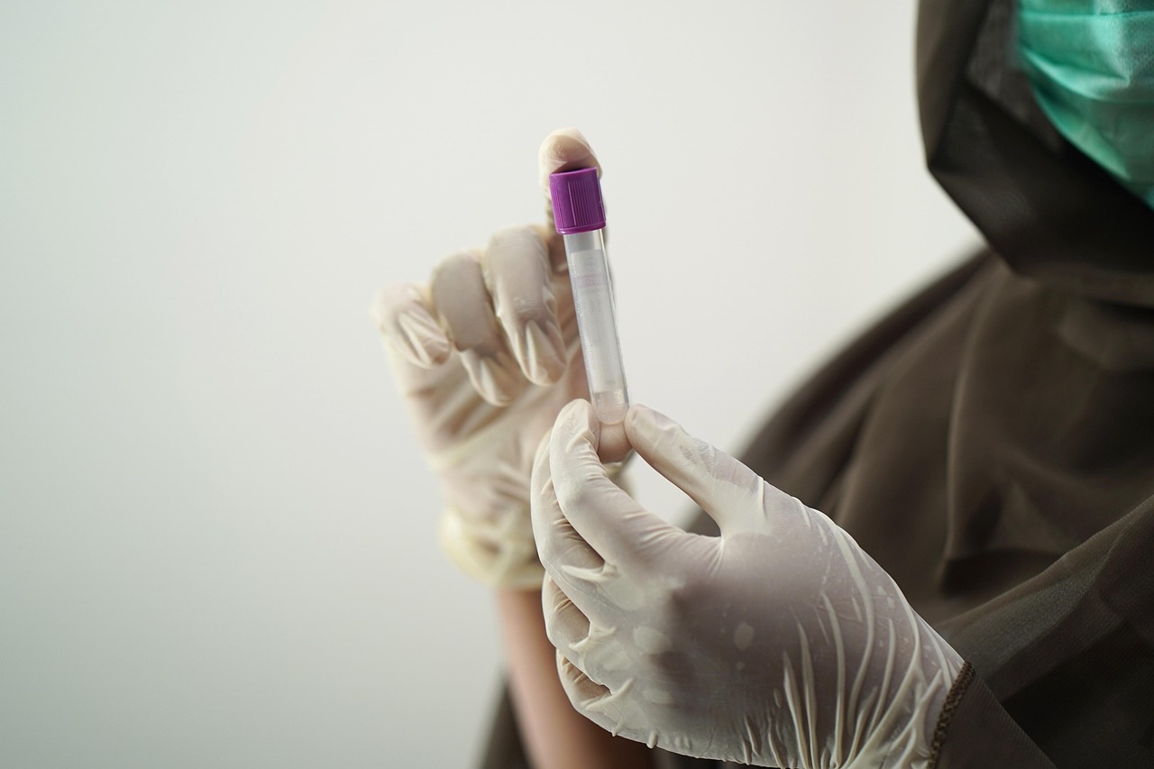 Probówka z próbką krwi w laboratorium