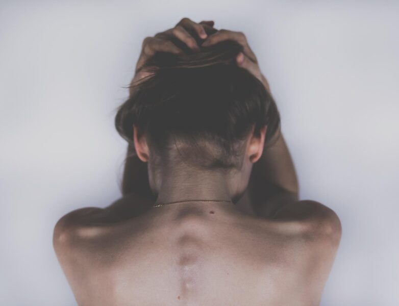 Kobieta z bólem pleców — niespecyficzne objawy endometriozy
